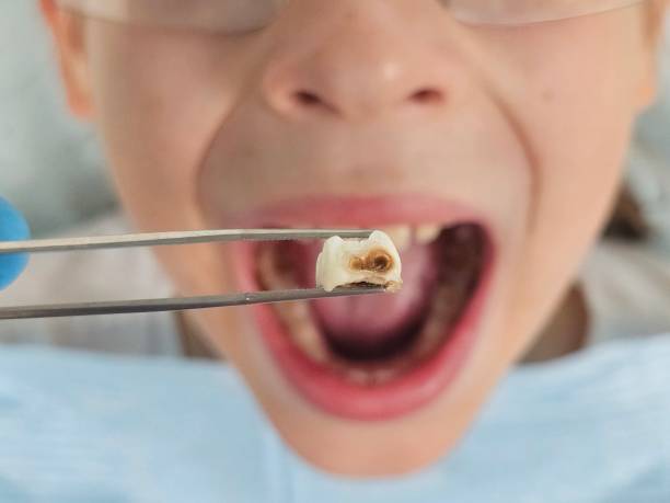 Best Emergency Denture Repair in Bridgetown, OH